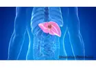 Premium Liver Detox Support supplement - Hepatoburn