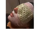Best Service For Chemical Peels in Worsley