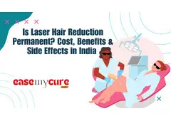 Get Smooth Skin with Laser Hair Removal in Delhi | Book at EaseMyCure