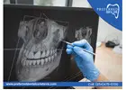 Discover Hidden Smiles at Your Dental X-Ray Clinic Near Me!