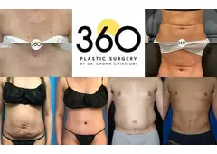 360 Plastic Surgery